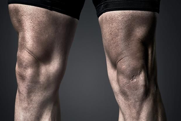 Mark Cavendish Legs